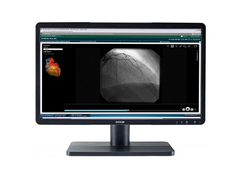 Barco Eonis MDRC-2122 22" Clinical Review Display Monitor