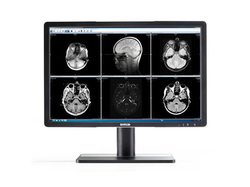 Barco Eonis MDRC-2122 22" Clinical Review Display Monitor
