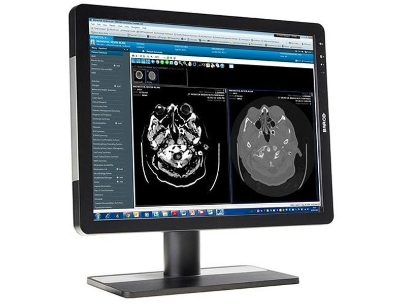 Barco MDRC-2221 2MP Clinical Review Display Monitor