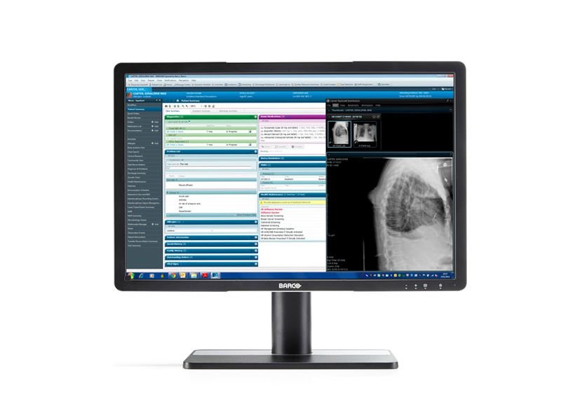 Barco MDRC-2222 22" Clinical Review Display Monitor