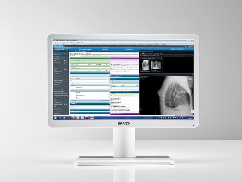 Barco MDRC-2222 22" Clinical Review Display Monitor