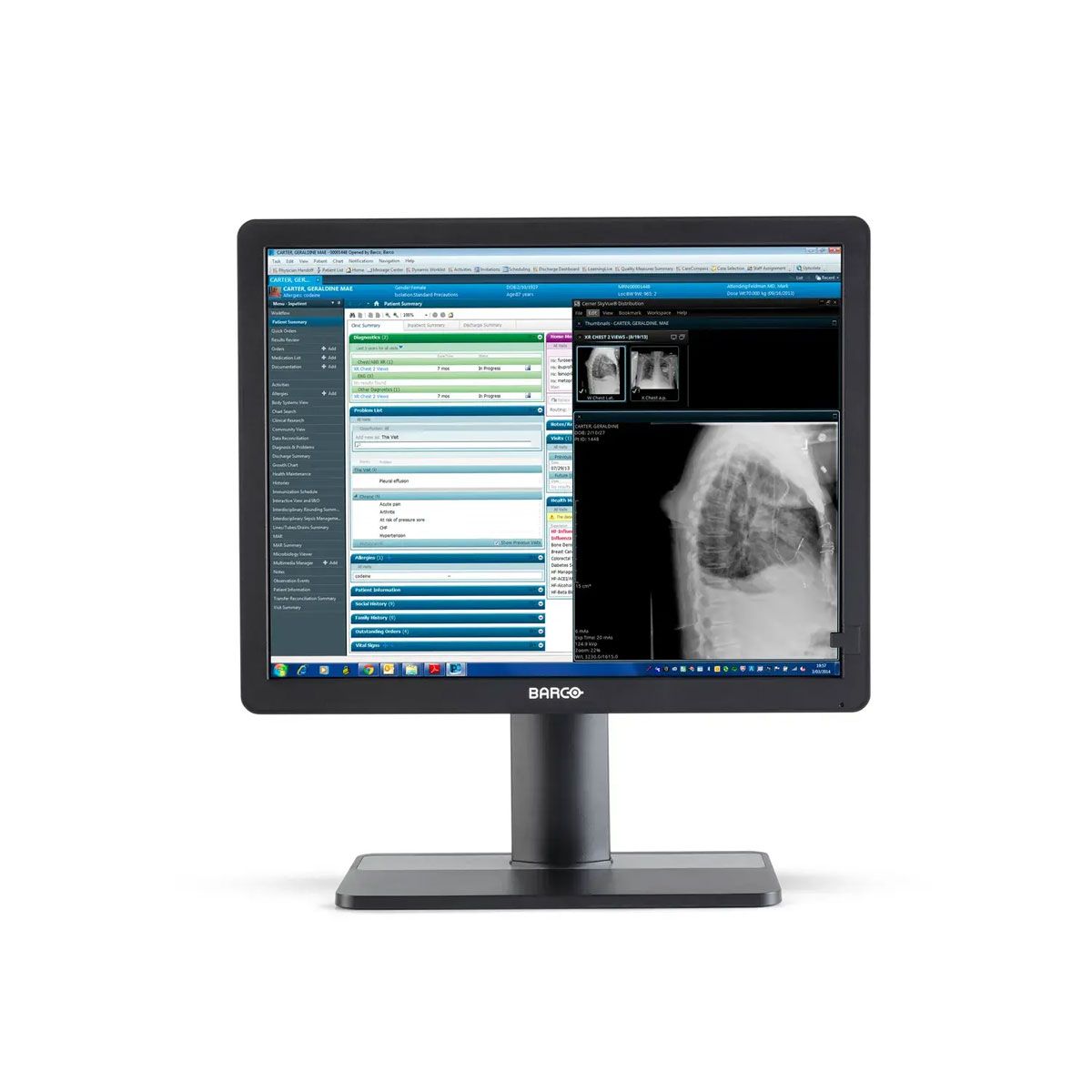 Barco MDRC-2421 21" Clinical Review Display Monitor