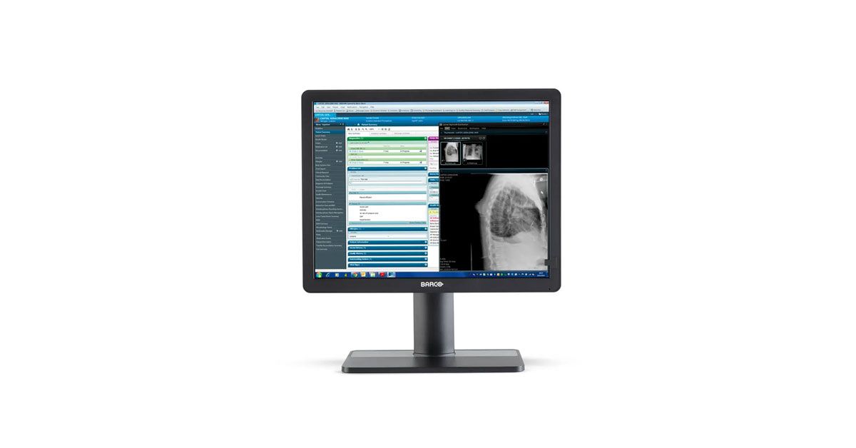 Barco MDRC-2421 21" Clinical Review Display Monitor