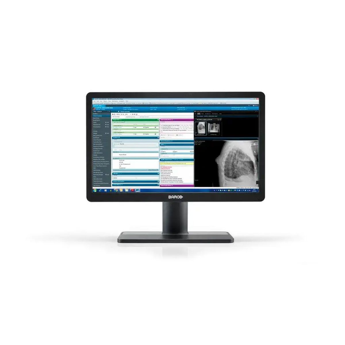 Barco MDRC-2422 22" FHD Clinical Review Display Monitor