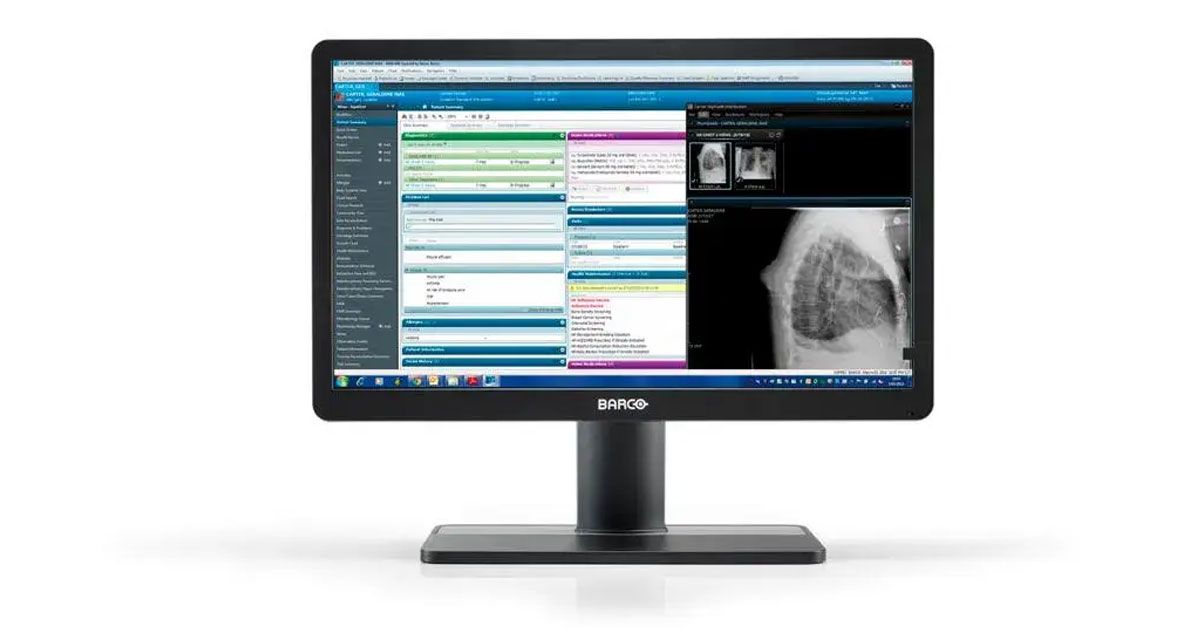 Barco MDRC-2422 22" FHD Clinical Review Display Monitor