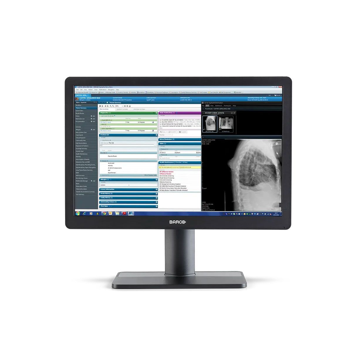 Barco MDRC-2424 24" Clinical Review Display Monitor