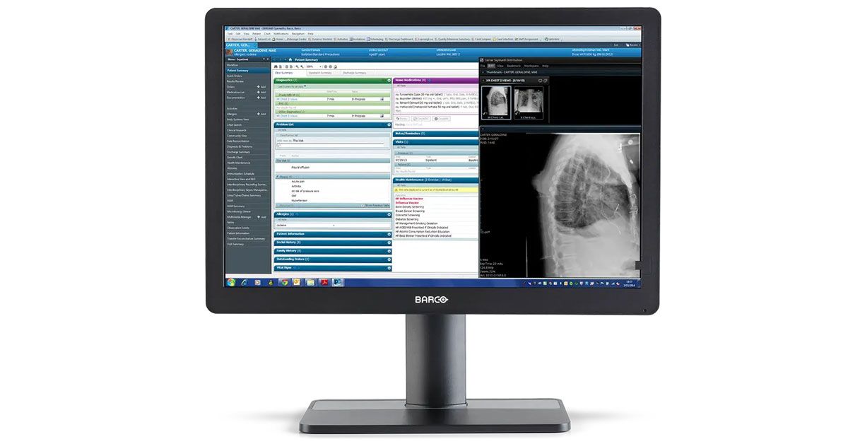 Barco MDRC-2424 24" Clinical Review Display Monitor