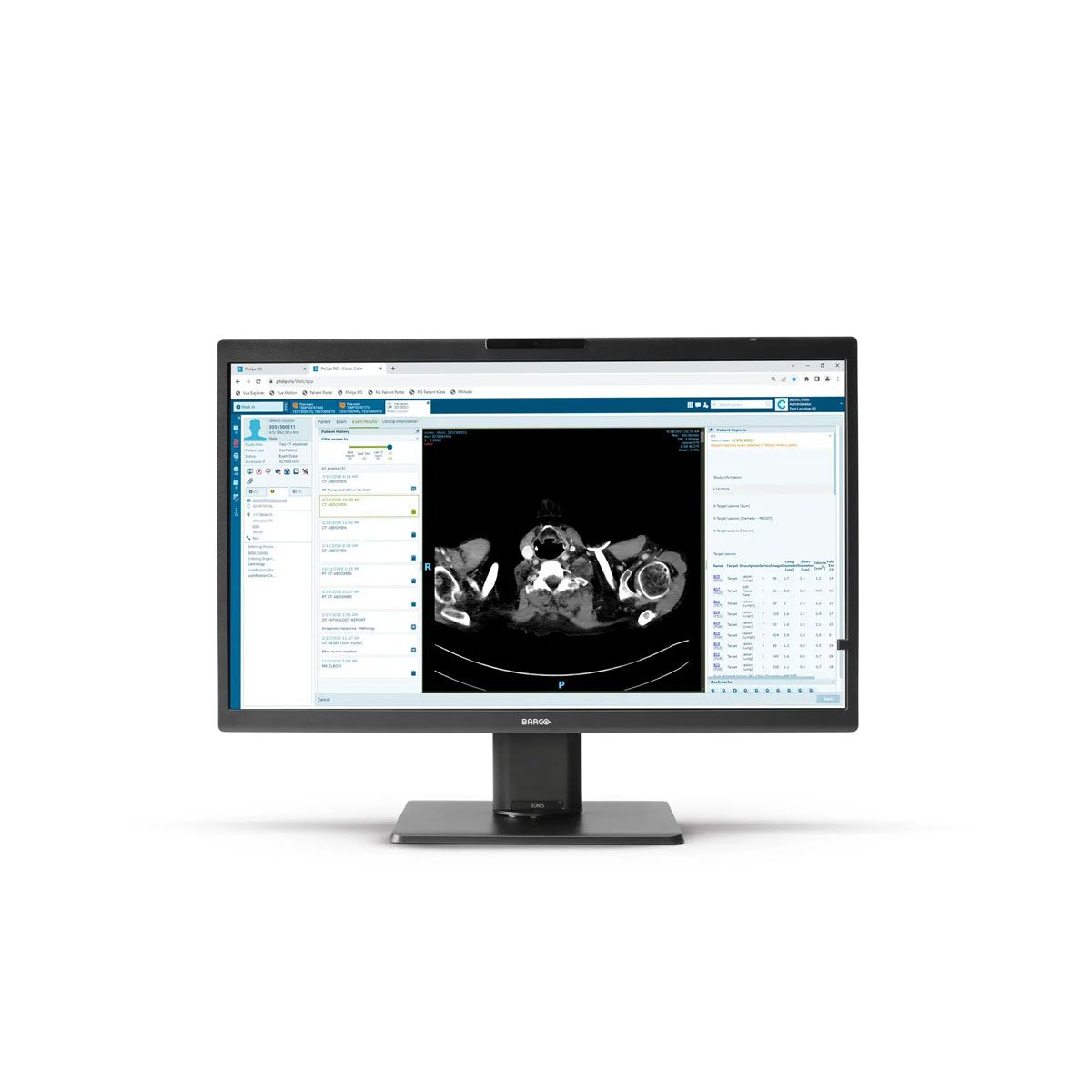 Barco MDRC-8132 32" Clinical Review Display Monitor