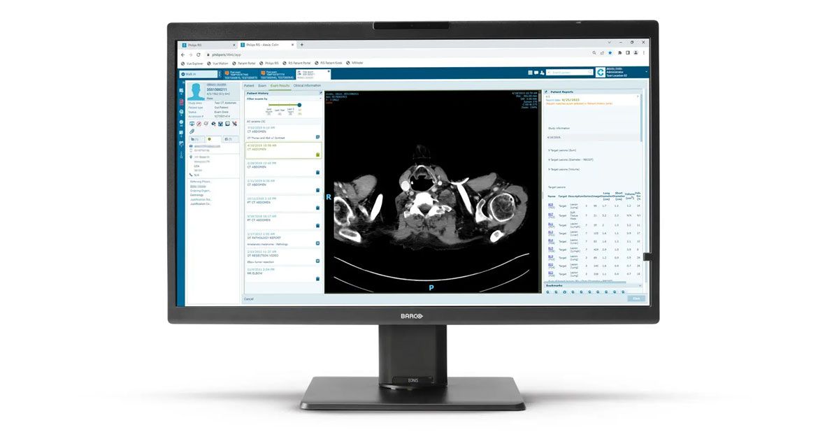 Barco MDRC-8132 32" Clinical Review Display Monitor