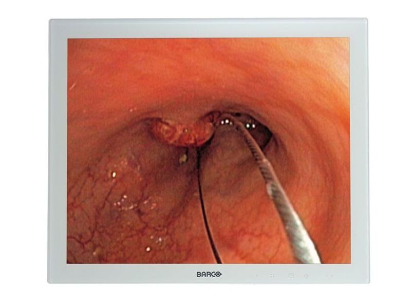 Barco MDSC-1119 19" SXGA Surgical LCD Monitor