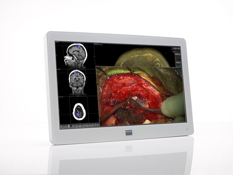 Barco MDSC-2224 24" WUXGA Surgical LCD Monitor
