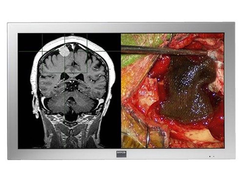 Barco MDSC-2242 42" FHD Surgical Monitor