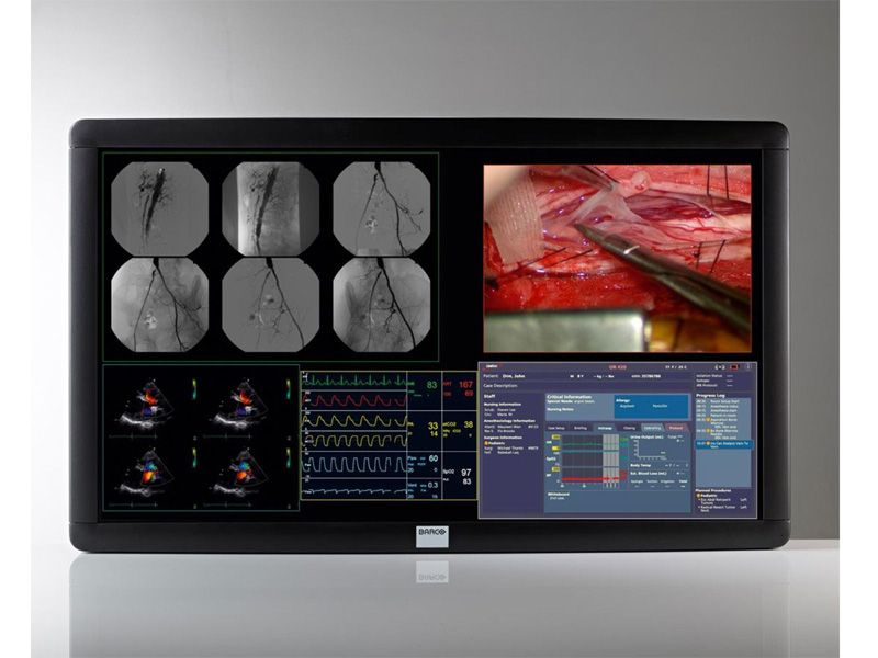 Barco MDSC-8156 56" 4K UHD Cath Lab Surgical LCD Monitor