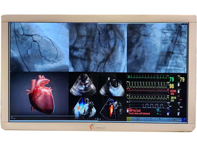 Barco MDSC-8156 56" 4K UHD Cath Lab Surgical LCD Monitor