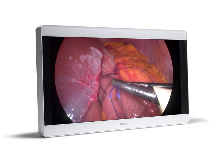 Barco MDSC-8232 31" 4K Surgical LCD Monitor