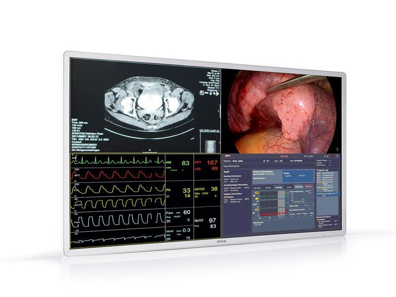 Surgical Display