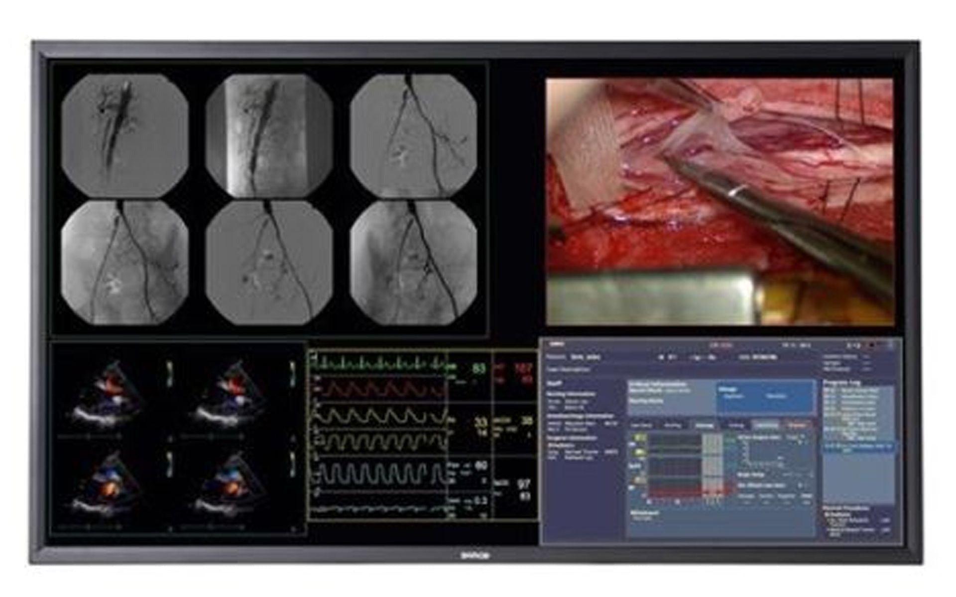 Cath Lab Monitor