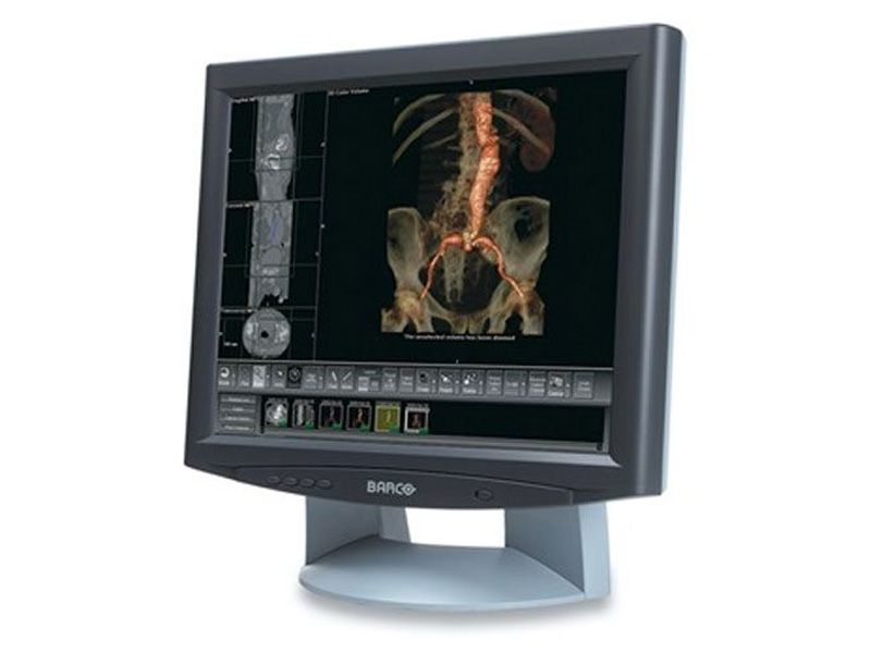 Barco MFCD-1219 19" SXGA Medical Display Monitor