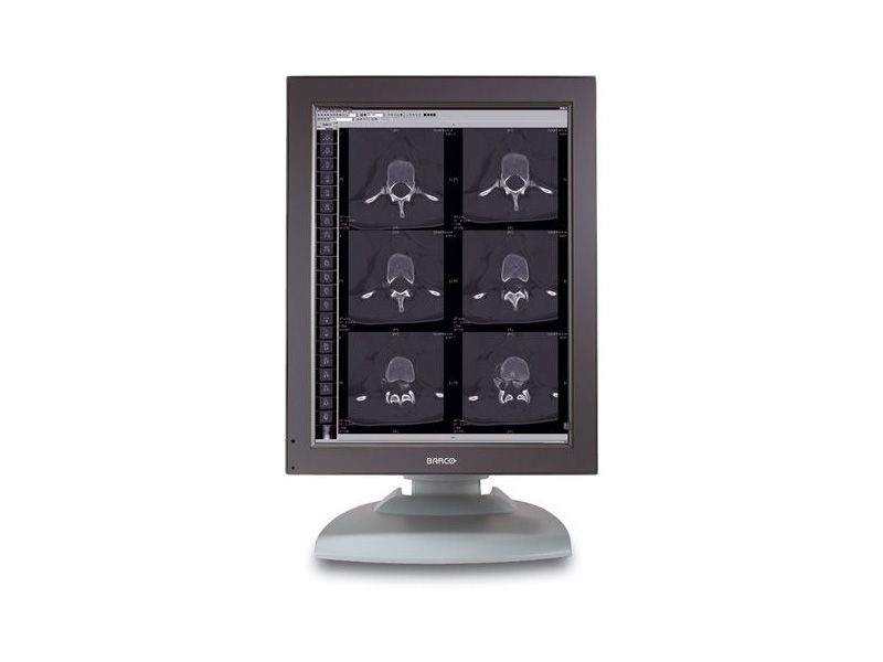 Barco MFGD-2320 2MP Diagnostic Radiology Monitor