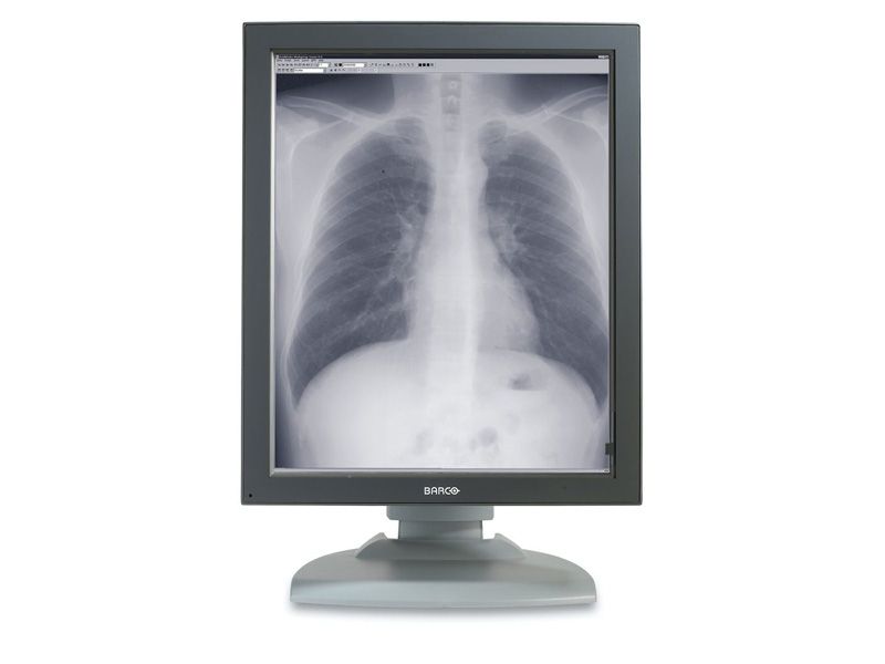 Barco MFGD-5421 5MP Diagnostic Radiology Monitor