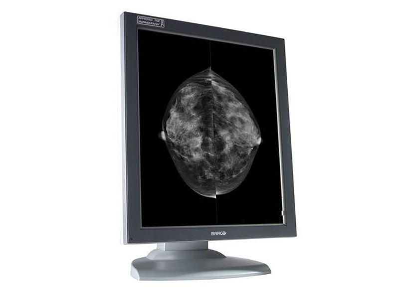 Barco MFGD-5621HD 5MP Diagnostic Radiology Monitor