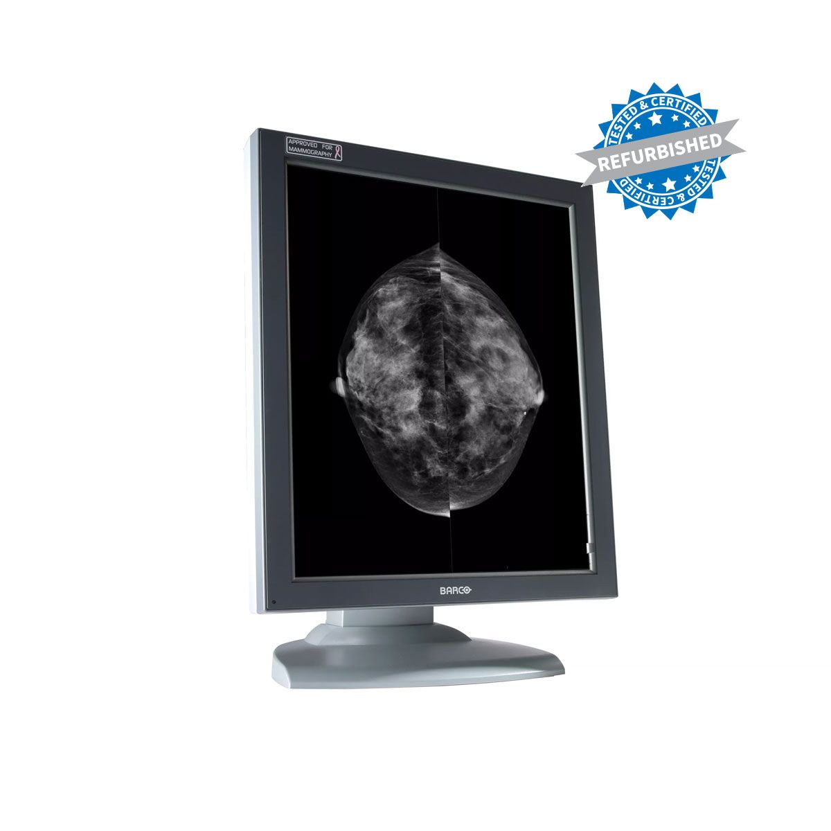 Barco MFGD-5621HD 5MP Diagnostic Radiology Monitor