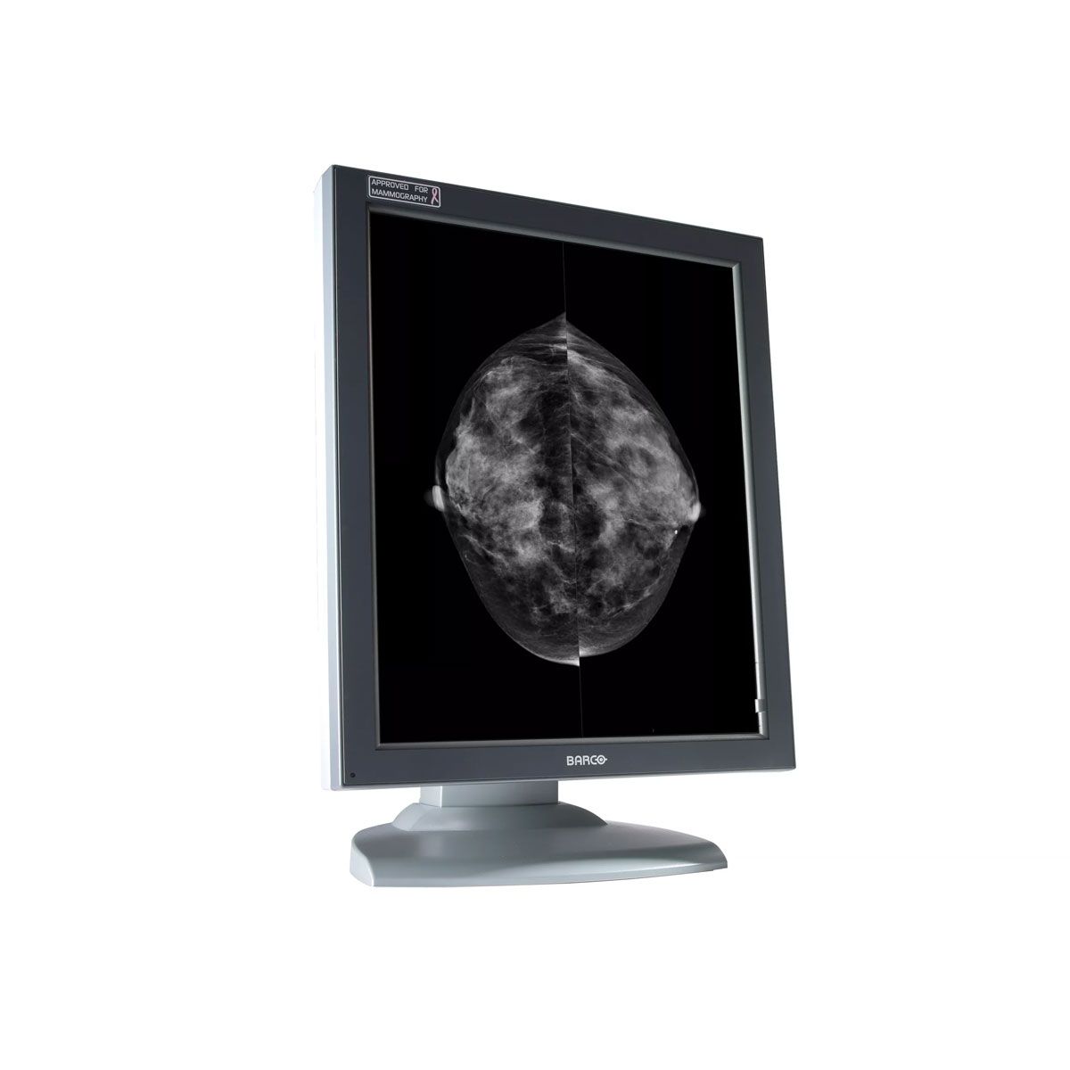 Barco MFGD-5621HD 5MP Diagnostic Radiology Monitor