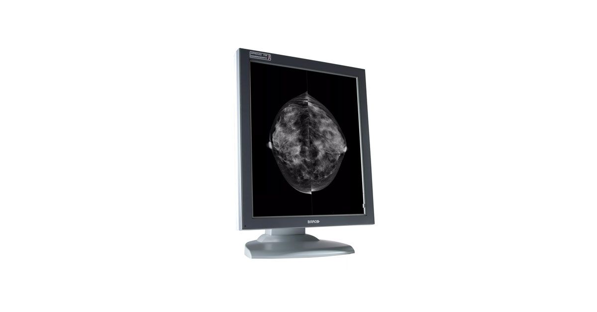 Barco MFGD-5621HD 5MP Diagnostic Radiology Monitor