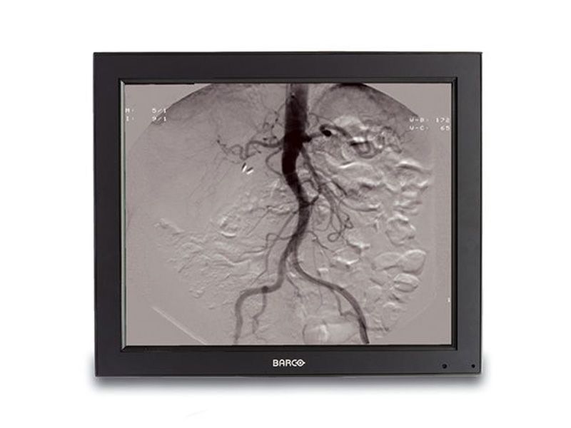 Barco MVGD-1319 TS 19" 1MP Medical Grade LCD Touchmonitor