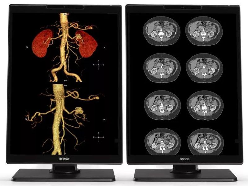 Barco MDNC-3521 3MP Diagnostic Radiology Monitor