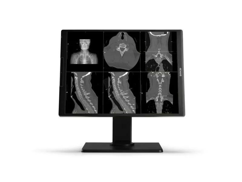 Barco MDNC-3521 3MP Diagnostic Radiology Monitor
