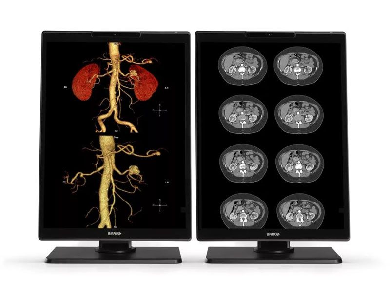 Barco MDNC-2521 2MP Diagnostic Radiology Monitor