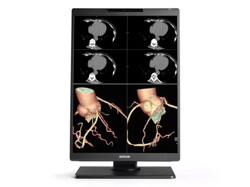 Barco MDNC-2521 2MP Diagnostic Radiology Monitor