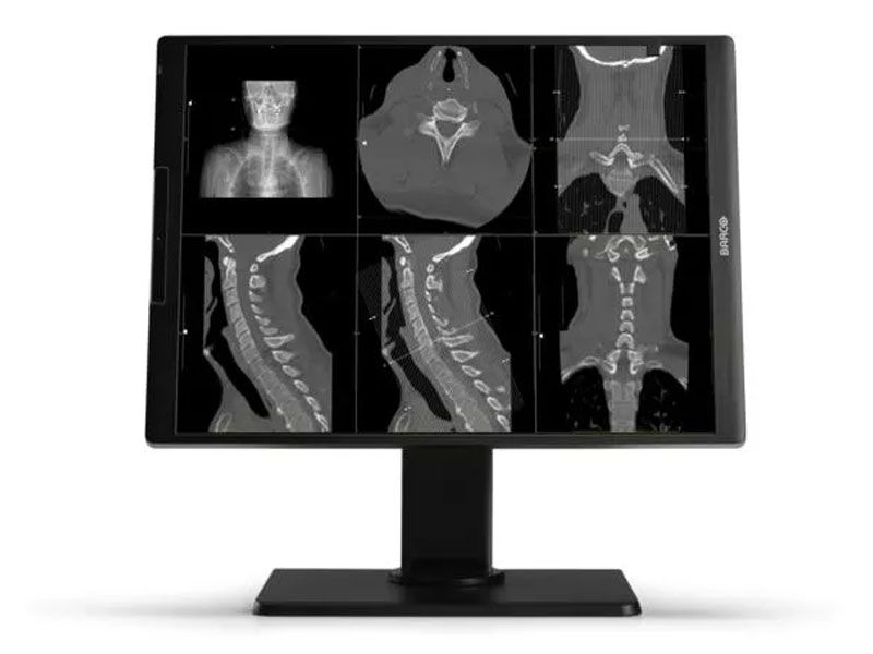 Barco MDNC-2521 2MP Diagnostic Radiology Monitor
