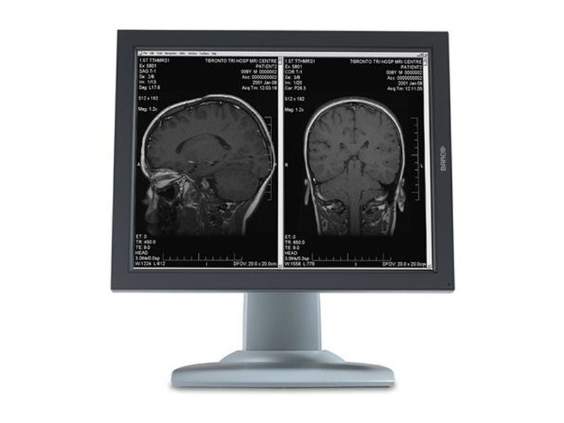 Barco MDNG-2121 2MP Diagnostic Radiology Monitor - Repair
