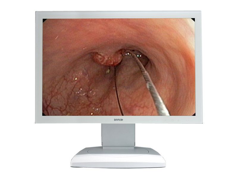 Barco MDSC-2124 24" WUXGA Surgical LCD Monitor