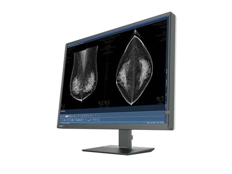 Beacon C1216W 12MP Diagnostic Radiology Monitor