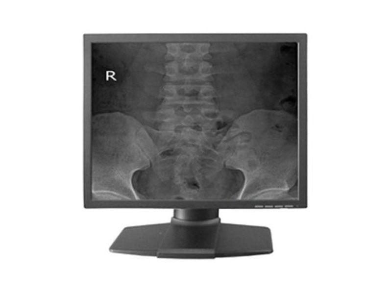 Beacon C14S 1MP Clinical Review Display Monitor