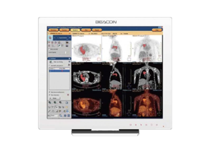 Beacon C14S 1MP Clinical Review Display Monitor