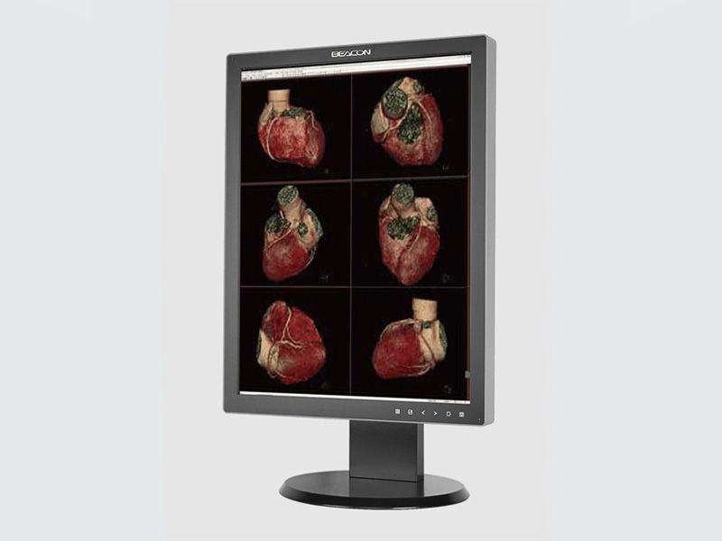 Beacon C22S+ 2MP Diagnostic Radiology Monitor