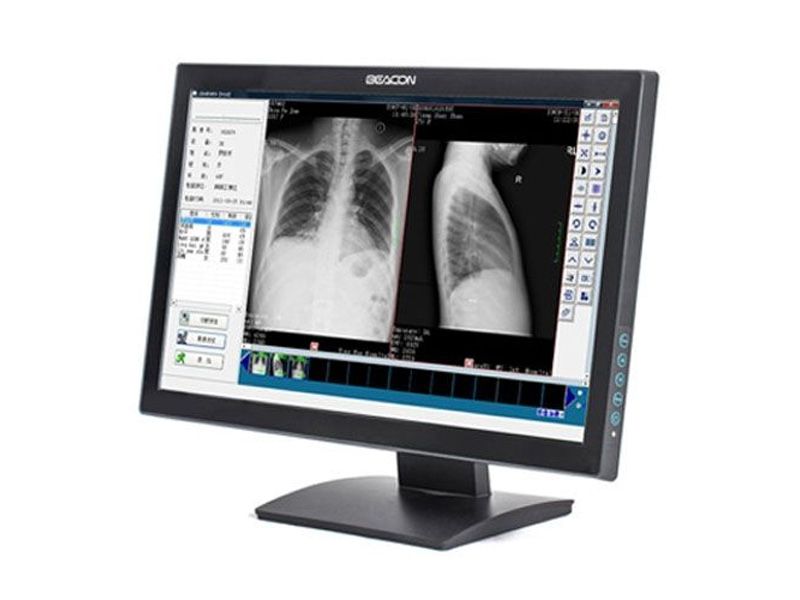 Beacon C22W 2MP Clinical Review Display Monitor