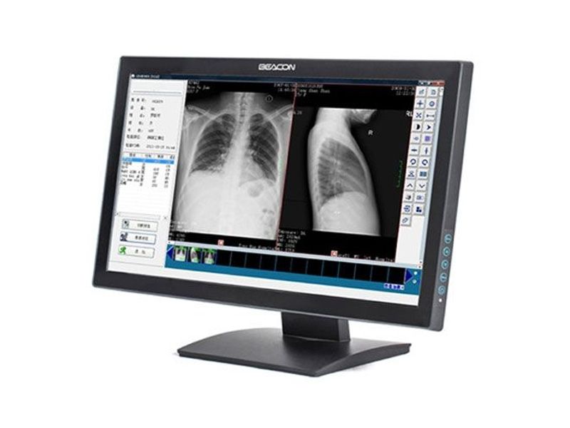 Beacon C23WT 2MP Clinical Review Touch Display Monitor