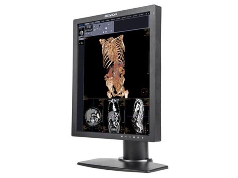Beacon C24S+ 2MP Diagnostic Radiology Monitor