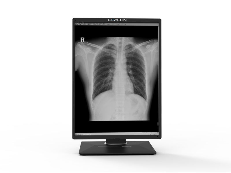 Beacon C310S 3MP Diagnostic Radiology Monitor
