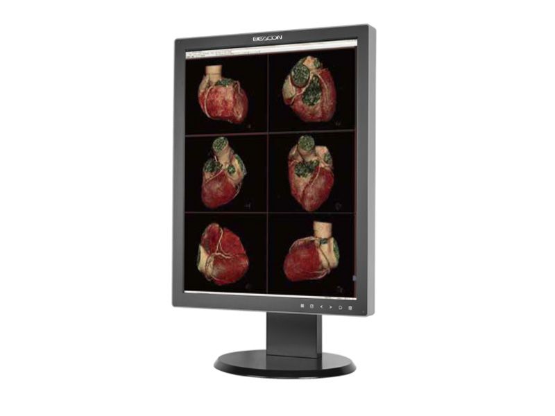 Beacon C32S+ 3MP Diagnostic Radiology Monitor