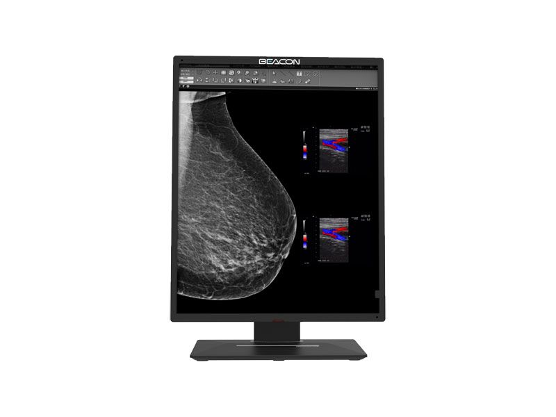 Beacon C516S 5MP Diagnostic Radiology Monitor