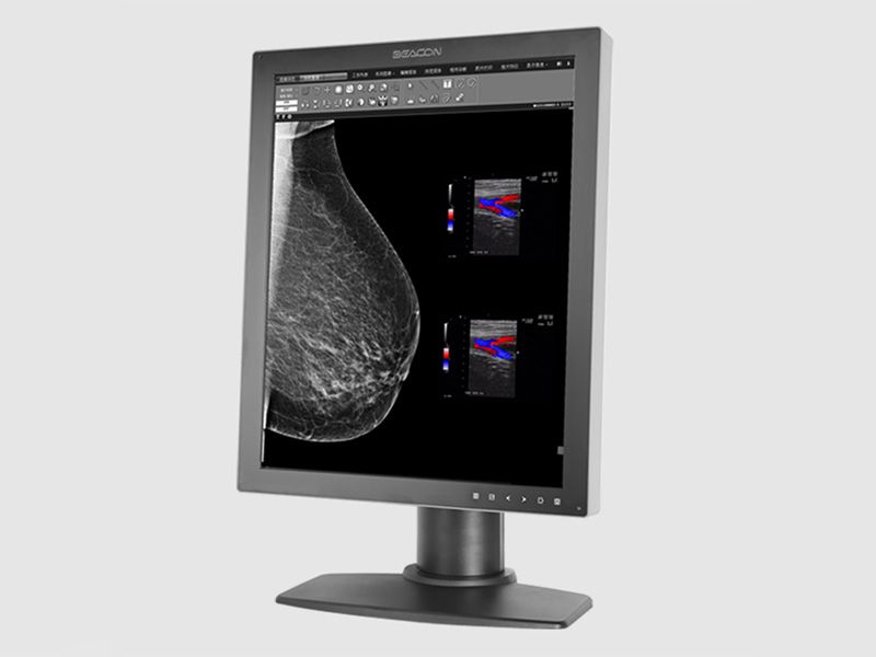 Beacon G52S+ 5MP Diagnostic Radiology Monitor