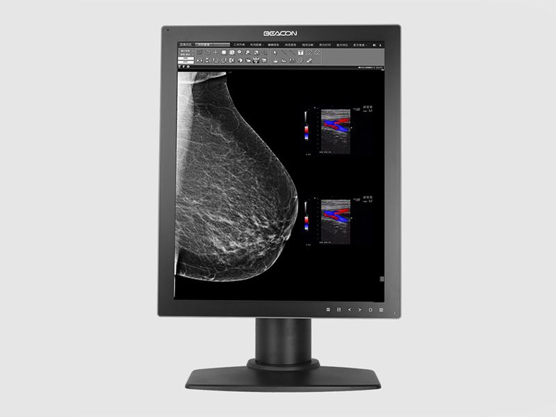 Beacon C53S+ 5MP Diagnostic Radiology Monitor
