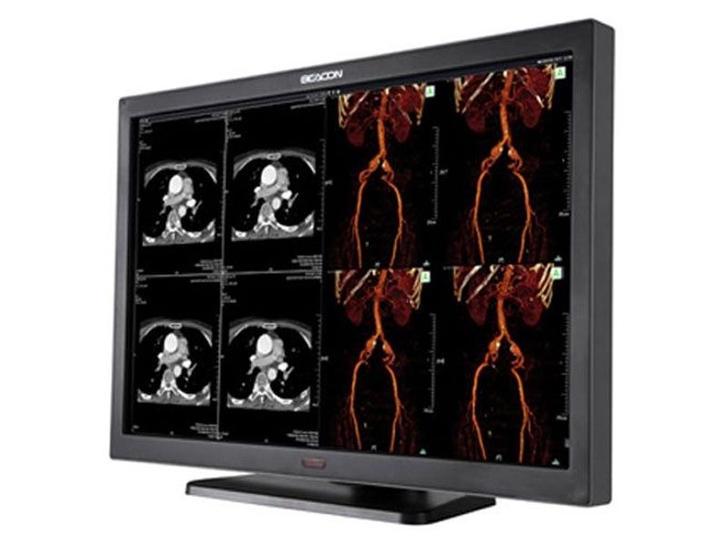 Beacon C61W+ 6MP Diagnostic Radiology Monitor
