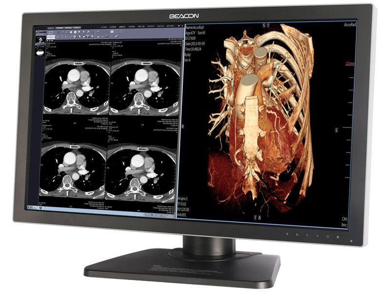 Beacon C83W+ (C83W Plus) 8MP Diagnostic Radiology Monitor